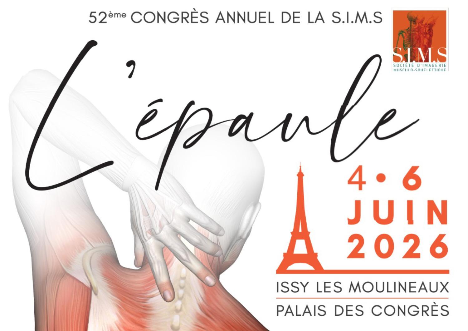 L'Épaule